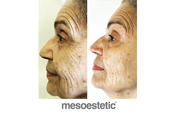 mod-jess-@getglow.se_